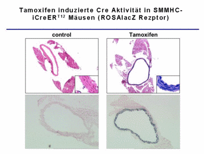 Abb. 4 Tamoxifen induzierte Cre Aktivitt in SMMHC-iCreERT2 Musen (ROSAlacZ Reporter).